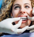 טיפולי יישור שיניים